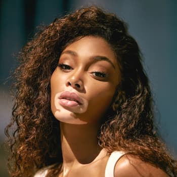 Winnie Harlow Photo