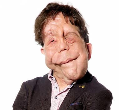 Adam Pearson's photo